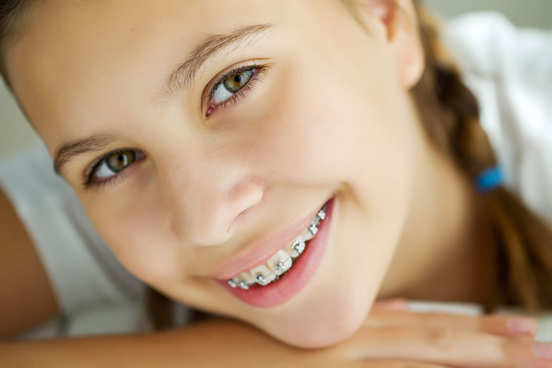 Think oral hygiene is tough with braces? Think again