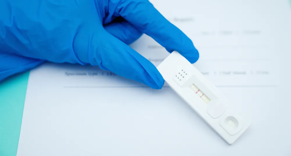 Free Rapid COVID-19 Test Now Available at Holiday Park No Appointment Needed