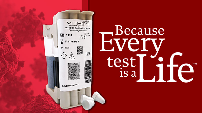 COVID-19 Antibody Test Released by Ortho Clinical Diagnostics